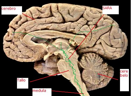 tronco cerebral, partes de